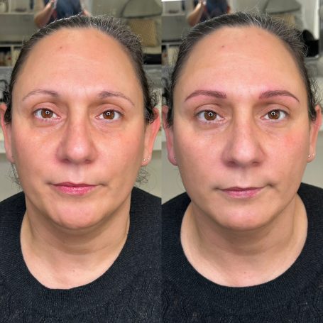 Antes y después — micropigmentación de cejas Antes y después micropigmentación cejas Noblesse Beauty Mallorca