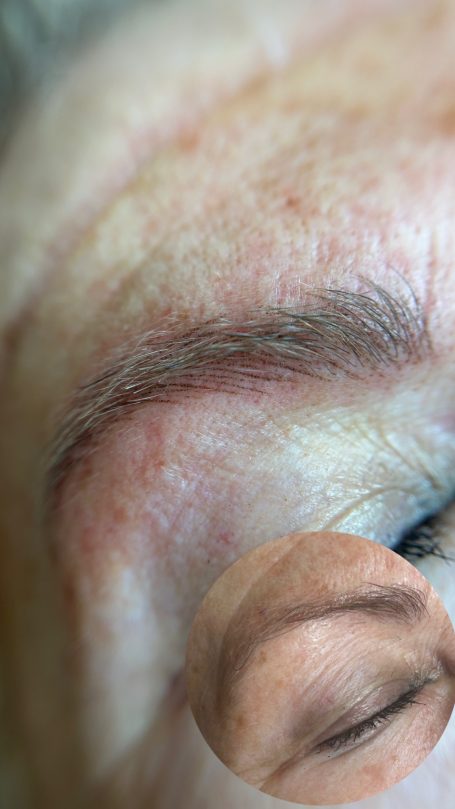 Antes y después — pelo a pelo Antes y después pelo a pelo micropigmentación cejas Mallorca